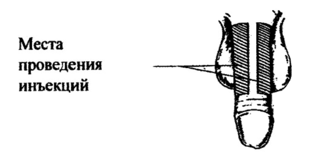 Каверджект - инструкция, наличие и цена в Минске