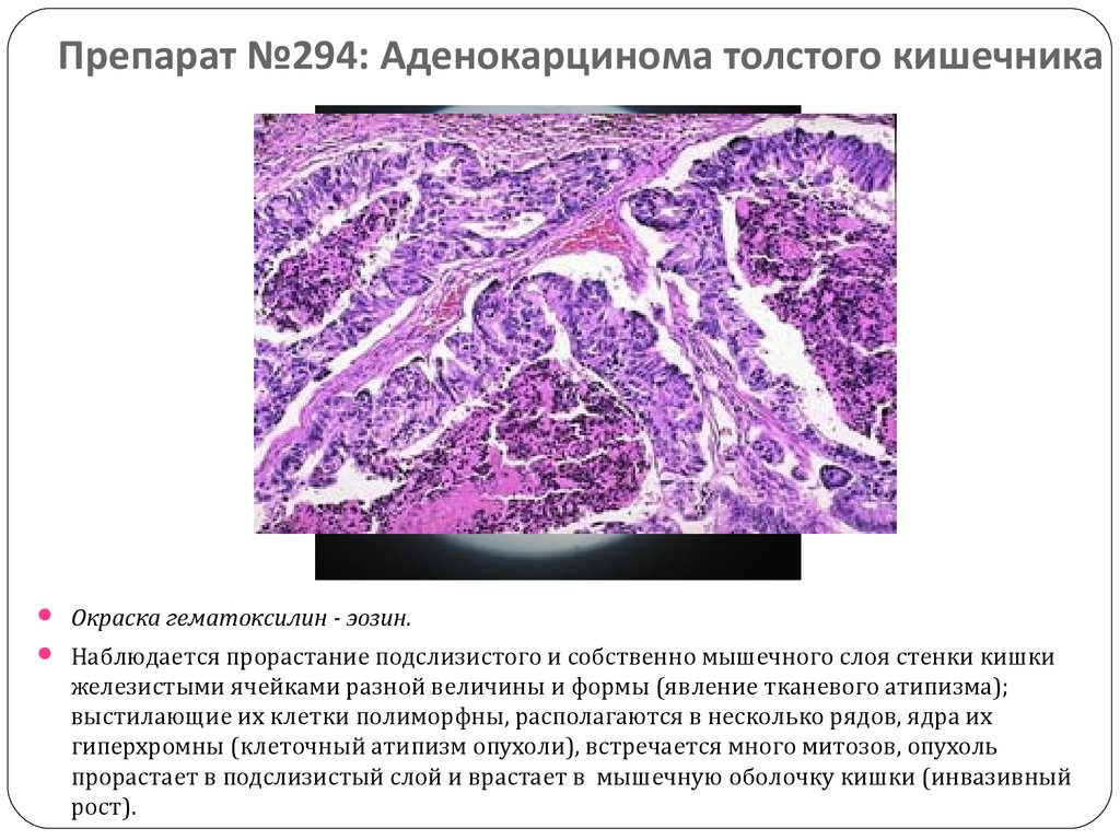 Небидо или Омнадрен сравнение и выбор лучшего препарата