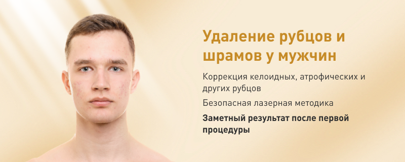 В Германии нельзя купить виагру без рецепта?