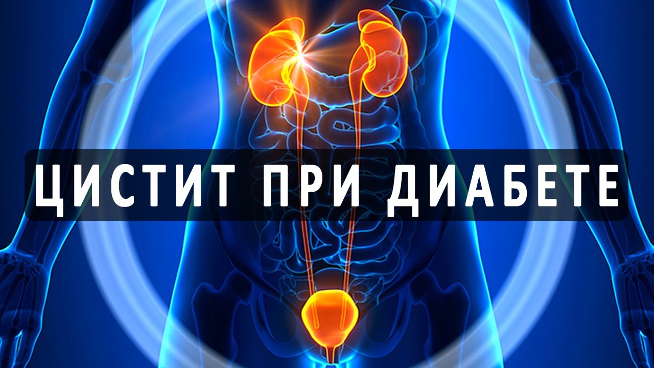 Как потенцию усилить при диабете - Искусственные заменители.