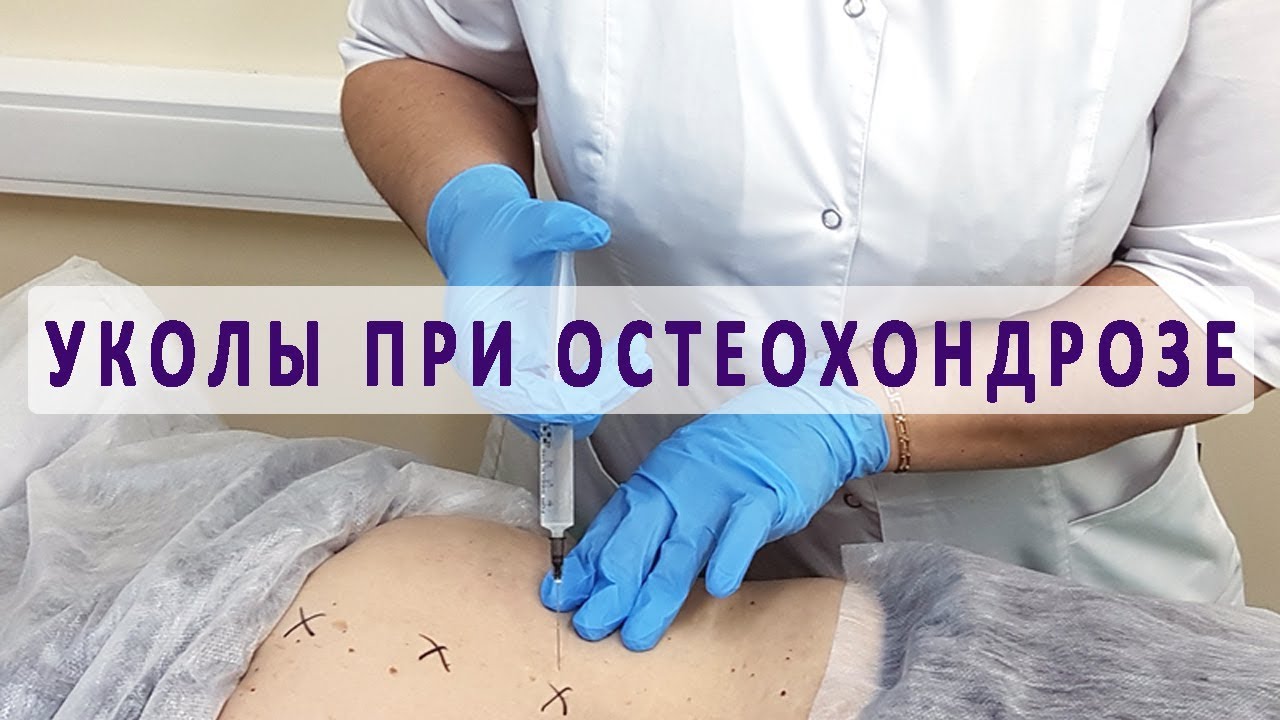 Купить Небидо раствор для инъекций 250мг/мл 4мл фл 1 шт тестостерона.