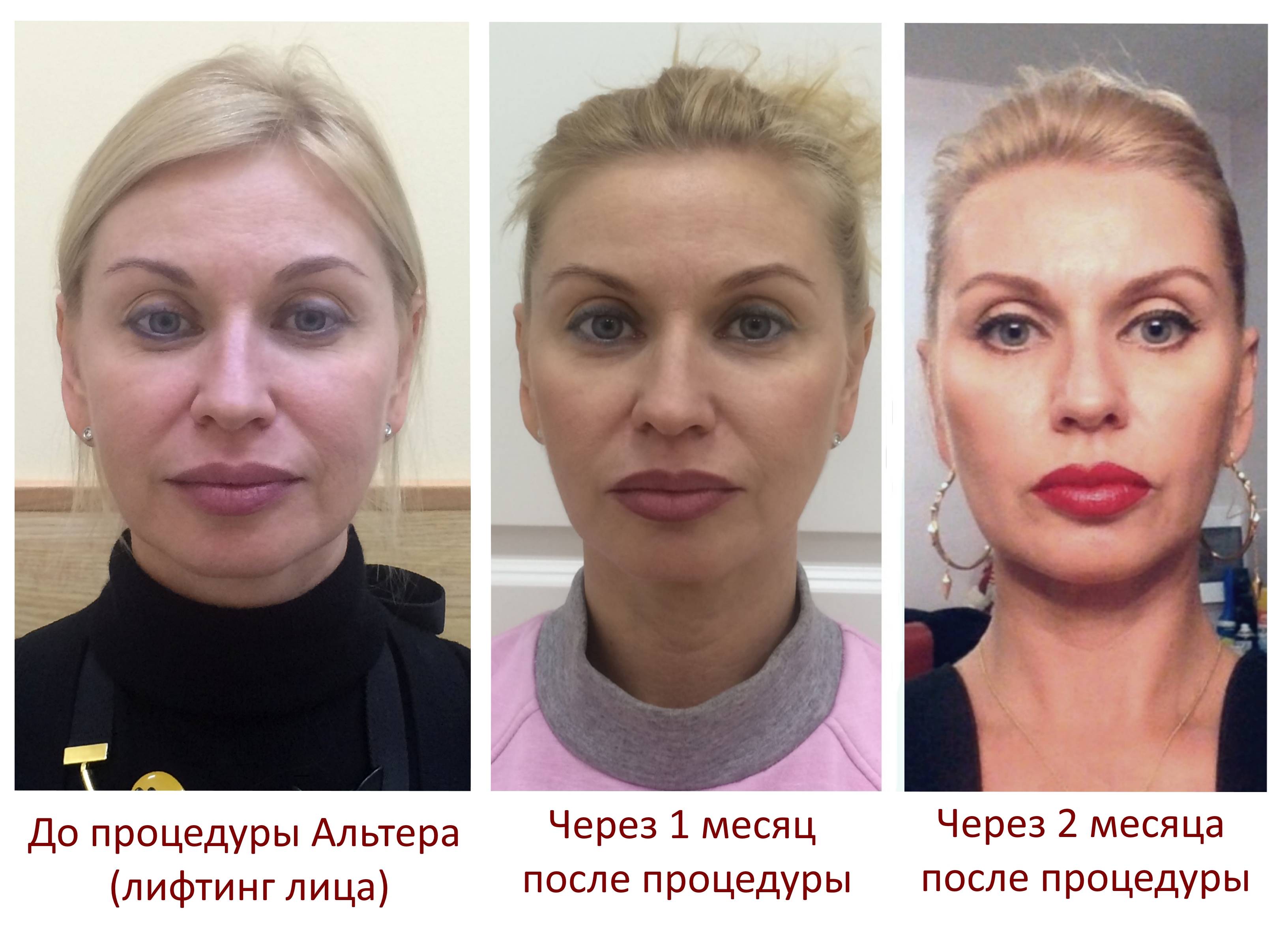 Уденафил Udenafil Описание - Видаль Россия