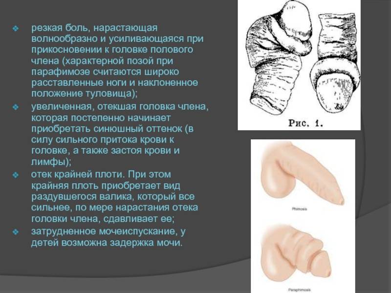 Полового акта у мужчин и женщин - Estet-Portal