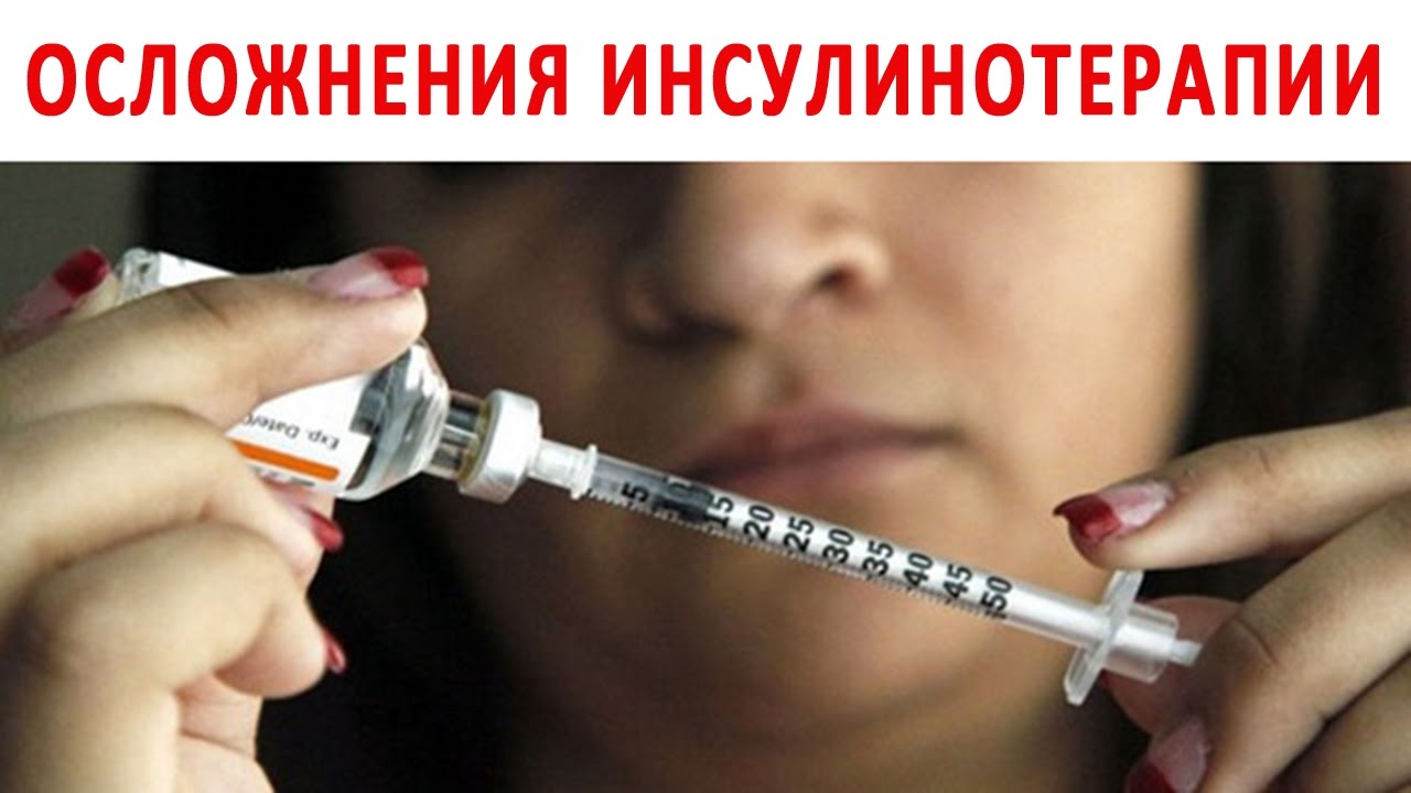 ЛЕВИТРА, таблетки - Здоровье