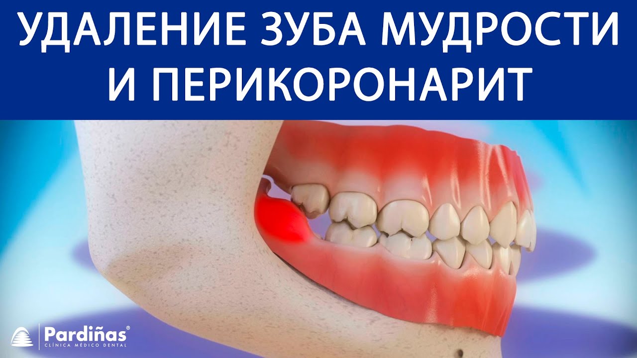 Сиалис - инструкиця по применению, цена, отзывы