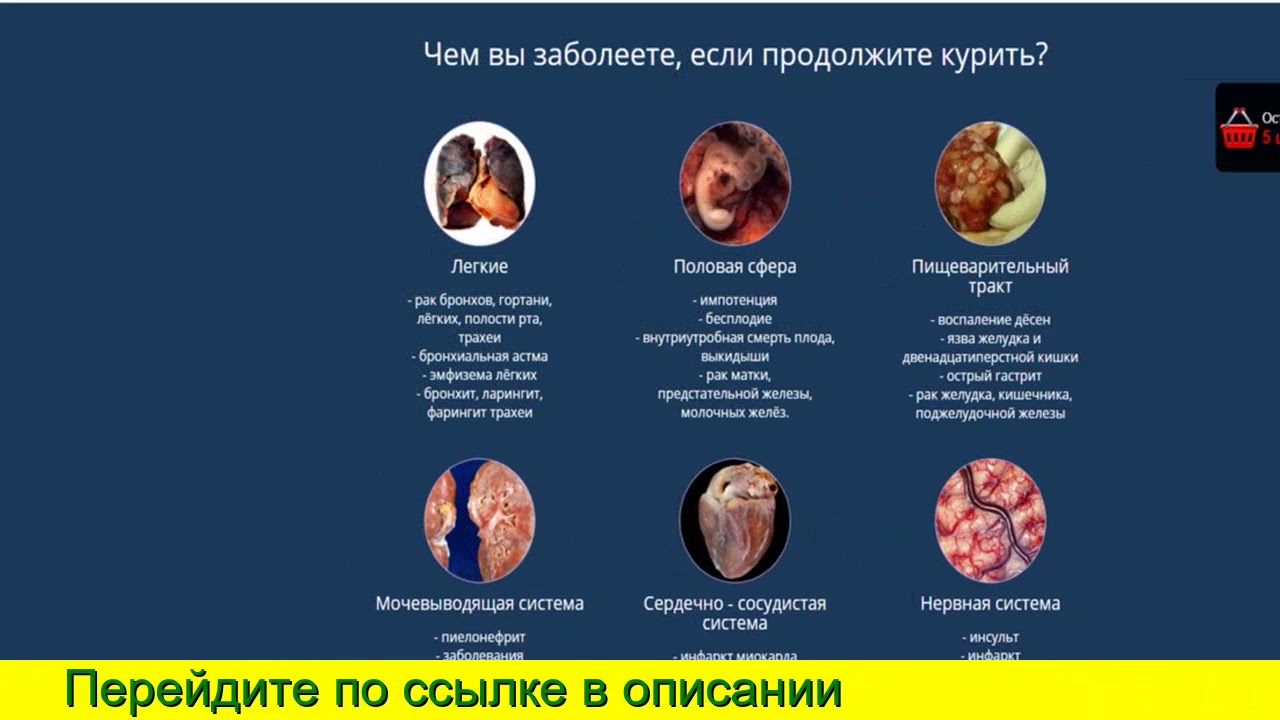 О таблетках тадалафил вертекс / Инъекционный препарат.